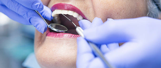 Best Emergency Dental Care for Sports Injuries in Random Lake, WI